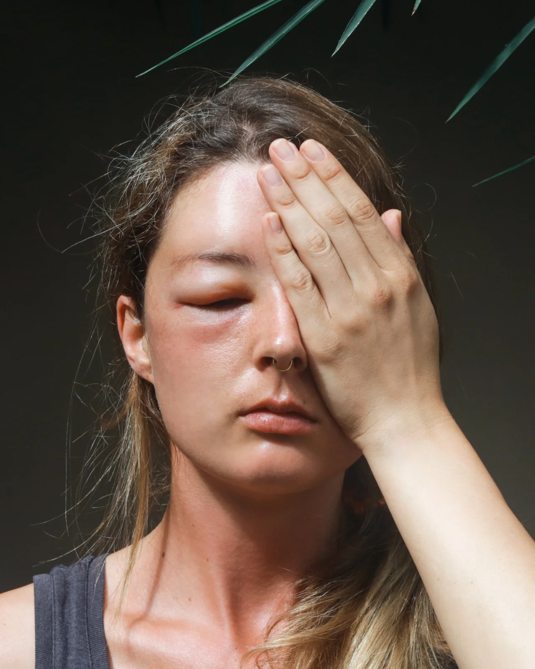 Eyelash Extensions Allergy